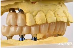 China Unmatched Accuracy Zirconia Implant Bridge Commitment To Comfort supplier