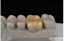 China Medium Translucency Emax Inlay Onlay Easy Cleaning And Non-toxic Biocompatibility In Materials supplier