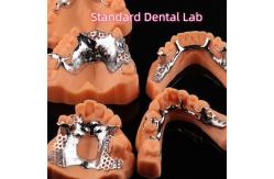 China Printed CoCr Denture Skelete Chrome Metal Partial Denture Design supplier