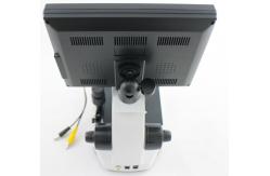 China Professional Microcirculation Microscope / Nailfold Capillary Microscopy with CCD Video Camera supplier