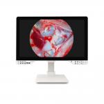 27 Medical Full HD Endoscope Camera For Gynecology Surgical With Light Source And Monitor for sale