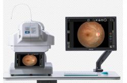 China Xenon Lights Automated Fundus Camera Digital Small Pupil Shooting Function supplier