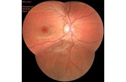 China Autofocus Non Mydriatic Fundus Camera System For Cataracts Check supplier