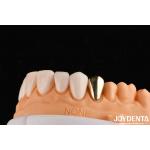 Wax Casted Gold 60K Metallic Dental Crowns Abrasive Resistant Gold Tooth Crown for sale