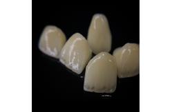 China Comfortable Zirconia Crown With Good Fitting And Precision Esthetics supplier