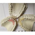 Temporary Soft And Elastic Valplast Invisible Denture