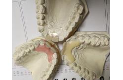 China Temporary Soft And Elastic Valplast Invisible Denture supplier