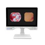 Medical 24 FHD Laparoscopic Imaging System 80Watts LED Cold Light Source & Endoscope Camera