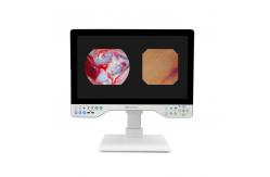 China Medical 24 FHD Laparoscopic Imaging System 80Watts LED Cold Light Source & Endoscope Camera supplier