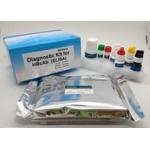 High Sensitivity Elisa Test Kit Easy Operate Hbcab Diagnostic High Efficiency for sale