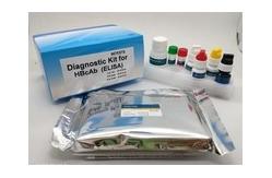 China High Sensitivity Elisa Test Kit Easy Operate Hbcab Diagnostic High Efficiency supplier