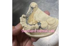China Skelete Chrome Cast Partial Denture Metal Framework ISO supplier