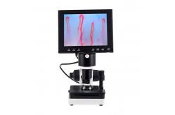 China Portable Led Display Nail Fold Capillaroscopy Microscope 400x Magnification supplier
