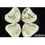 Good Fit Dental Metal Framework Metallic Material For Durable Dental Restorations for sale