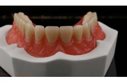 China Dentsply Lucitone 199 Acrylic Denture For Full Arch Natural Look supplier