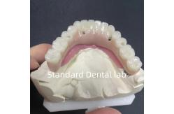 China Esthetic Restoration All On 4 Dental Implants Zirconia Hypo Allergenic supplier