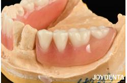 China Diverse And Lightweight Resin Material Acrylic Denture Finish supplier
