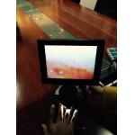High Accuracy Nail Folding Microcirculation Microscope with High Definition Video Screen 8 inch