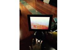 China Hospital Microcirculation Microscope Nailfold Video Capillaroscope Detection Instrument supplier