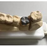 ISO FDA CE Dental Metal Post And Core Crown PFM Good Fit for sale