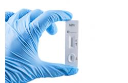 China High Quality Monkey Pox Virus Antigen Rapid Test Kit supplier