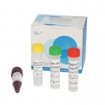 Monkeypox Real Time PCR Kit Laboratory Rapid Test Monkeypox Virus Test Kit for sale