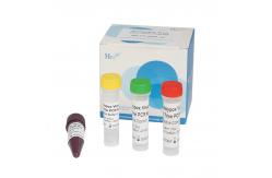 China PCR Kit Monkeypox Virus Detection Kit Laboratory Rapid Test Kit supplier