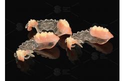 China Vertex Clear  Flexible Partial Virtually Unbreakable Low Allergy Risk Full Partial Denture supplier