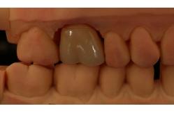 China Mill and Centring Full Zirconia Crown , China Dental Lab Fast Delivery supplier