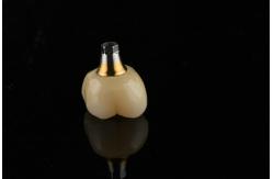 China titanium 10mm Single Tooth Dental Implants Replacement Abutment Self Tapping Sandblasted supplier