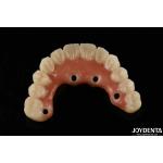 Quick Drying Titanium Bar Acrylic Teeth Finishing Clear Acrylic Teeth Dental Supplies for sale