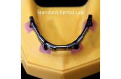 China Titanium Implant Supported Dentures Precise Ivoclar Denture Over Implants ISO FDA CE supplier