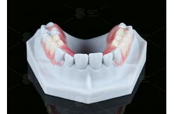 China Natural Looking Valplast Partial Denture Longevity Highly Resistant To Fractures supplier