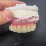 Malo Bridge Hybrid Zirconia All On Four / Six Zirconia Implant Bridge TItanium Bar