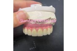 China Malo Bridge Hybrid Zirconia All On Four / Six Zirconia Implant Bridge TItanium Bar supplier