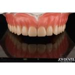 Acrylic Teeth Finish Lightweight Resin Material Dental Restorations Tooth Arrangement for sale