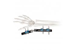 China Orthopedic Surgical External Fixation Device Wrist supplier