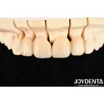 High Translucency Layered Zirconia 3 W/mK Thermal Conductivity For Exceptional Performance for sale