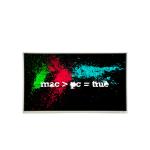 4.7 inches rectangle lcd screen Display LM32010P for injection molding machine for sale