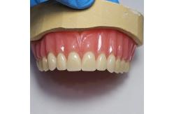 China Dentsply Lucitone 199 Acrylic Denture For Full Arch Natural Look supplier