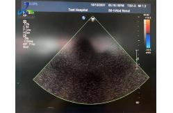 China  S5-1 Replace Lens Connecting Cable 2D Probe Repair supplier