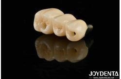 China High Aesthetics High Flexural Strength 1000 MPa Full Zirconia For Standards supplier