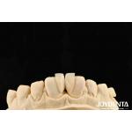 High Durability Micro Veneer 0.2mm Thickness And Dependable Performance for sale