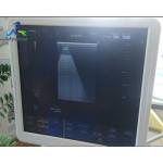 Hitachi Aloka Ascendus Image Shadow Ultrasound Machine Repair Replace TRX Board for sale