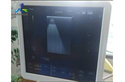 China Hitachi Aloka Ascendus Image Shadow Ultrasound Machine Repair Replace TRX Board supplier