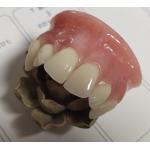 ISO13485 Conventional Denture Upper Acrylic Partial