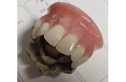 China ISO13485 Conventional Denture Upper Acrylic Partial supplier