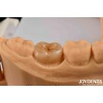 High Precision Applications Full Zirconia With High Resistance To Thermal Shock
