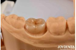 China High Precision Applications Full Zirconia With High Resistance To Thermal Shock supplier