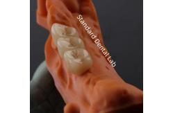 China Digital CAD CAM Dental Lab Crowns Translucent Layered Zirconia Crown supplier